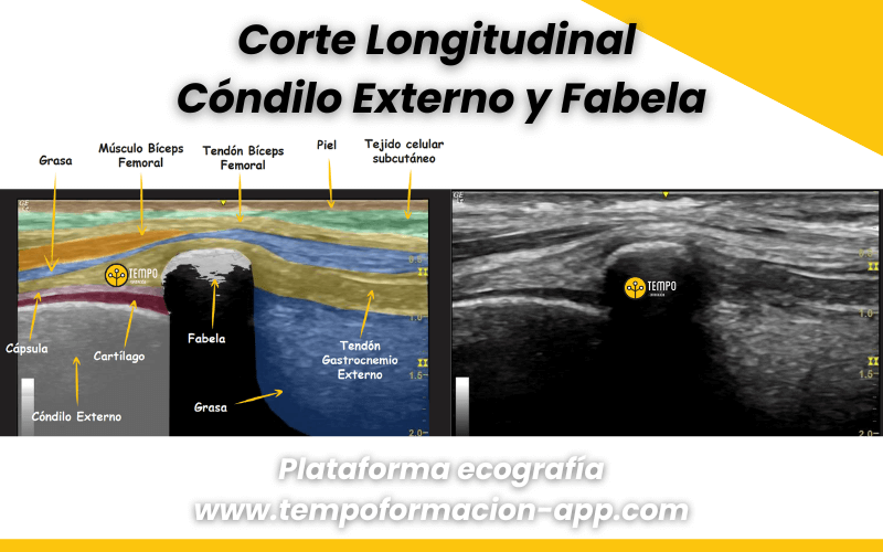 Anatomía Y Ecografía En Rodilla Tempo Formación 1054